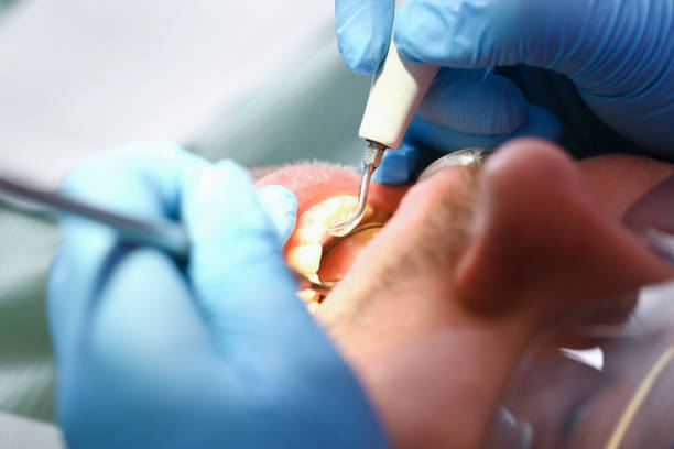 Best Emergency Treatment for Jaw Pain or Injury in North Royalton, OH